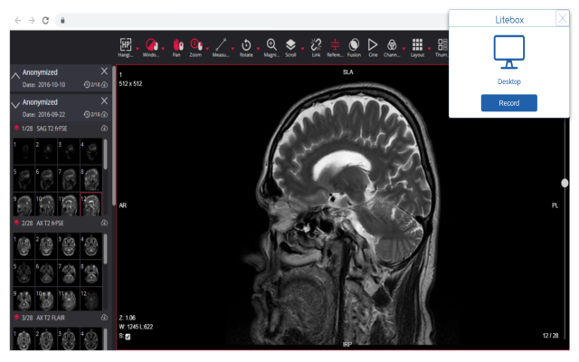 Litebox chrome谷歌浏览器插件_扩展第1张截图