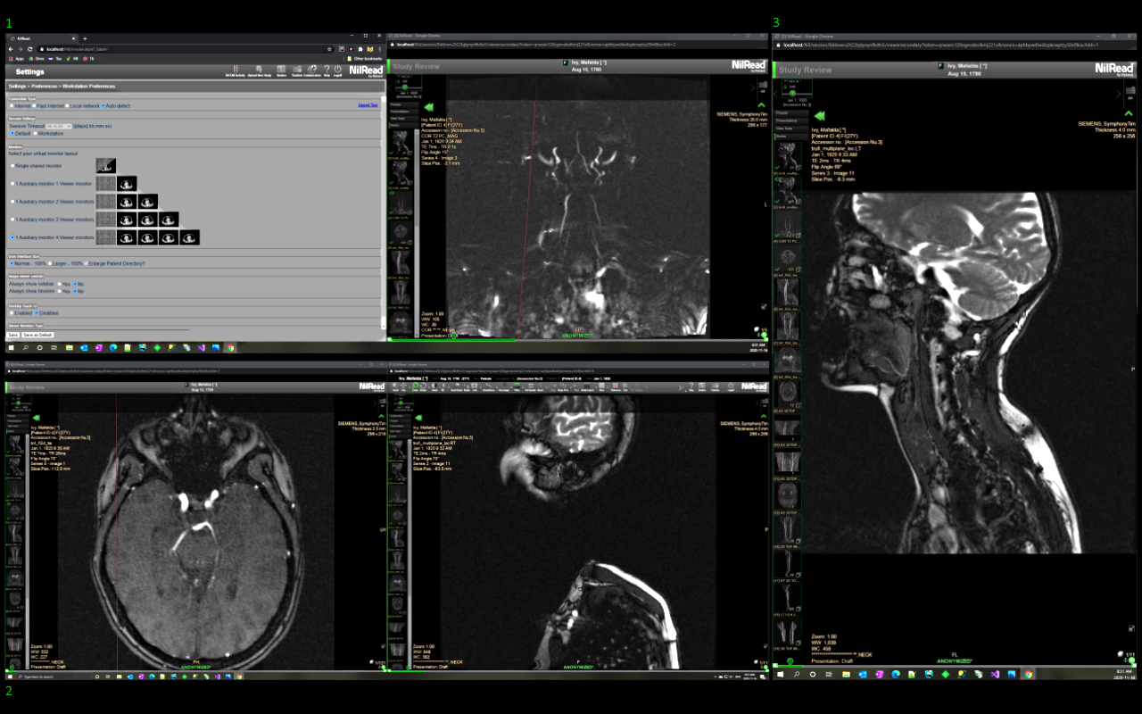Hyland NilRead WinMan chrome谷歌浏览器插件_扩展第1张截图