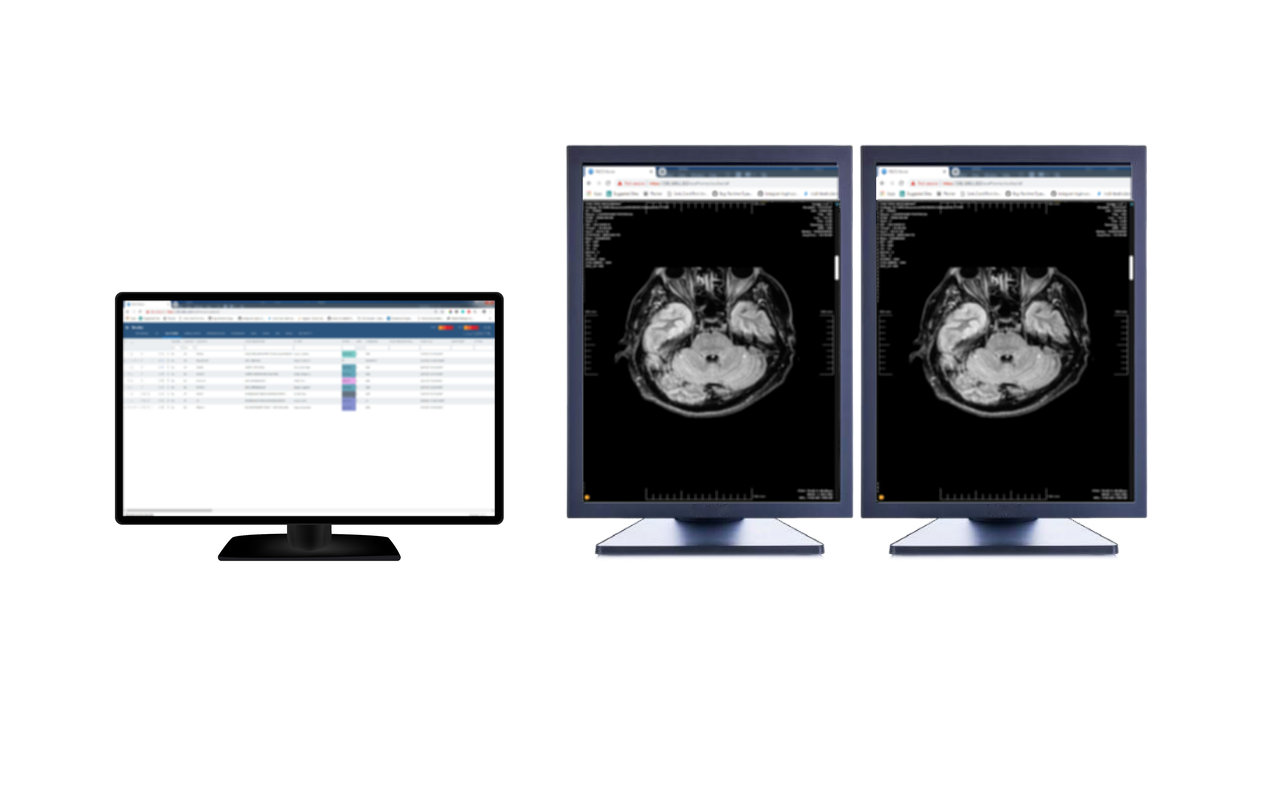Exa RIS/PACS Multi-monitor chrome谷歌浏览器插件_扩展第1张截图