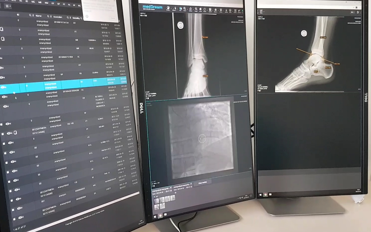 MedDream browser extension for multi-monitors - 截图 1